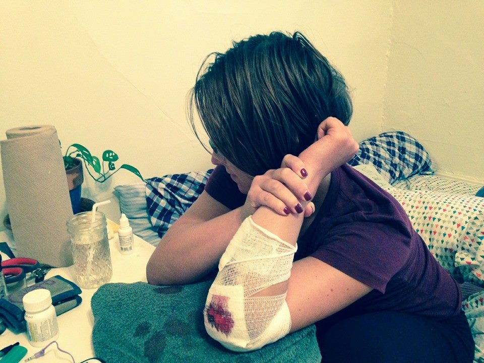 Why relive this traumatic injury?